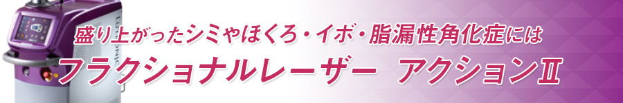 盛り上がったシミやほくろ・イボ・脂漏性角化症 フラクショナルレーザー アクションⅡ
