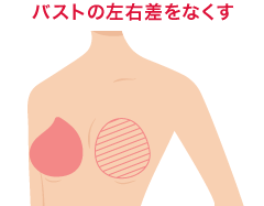 バストの左右差をなくす