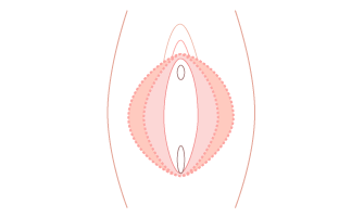 小陰唇の悩み