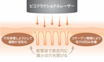 肌の再生力をアップ