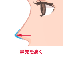 鼻先を高く